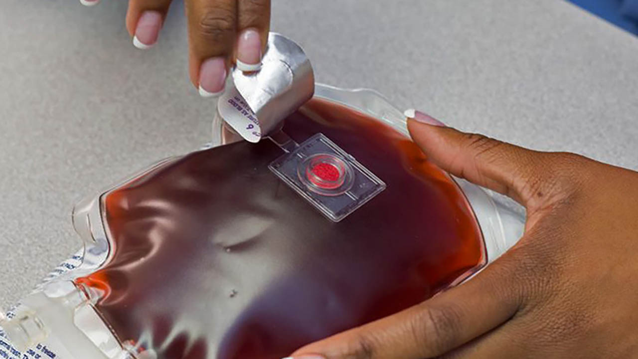 A woman checks a Safe-T-Vue sensor on a blood bag