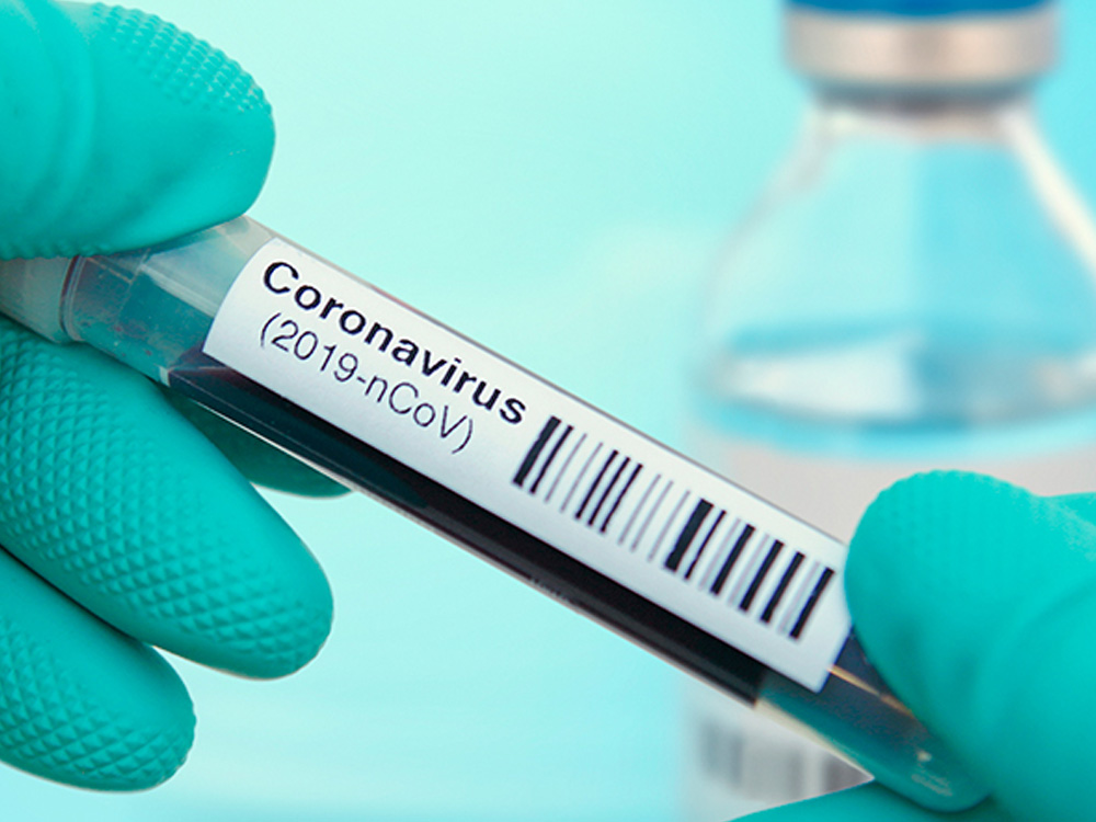 COVID-19 Lab Sample 4:3 1000 High volume specimen testing