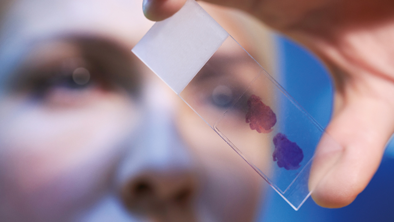 A woman looks at a specimen on a lab slide